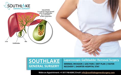 Discover How to Manage the Painful Side Effects of Gallstone Surgery